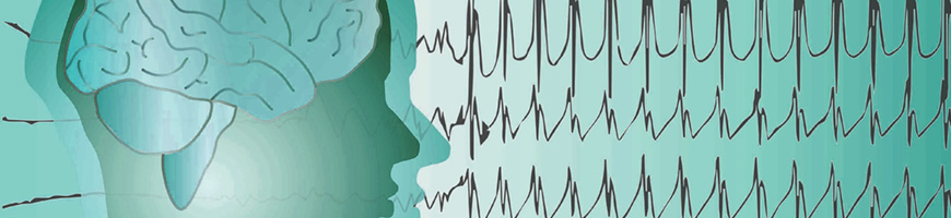 zorgaanbod epilepsie